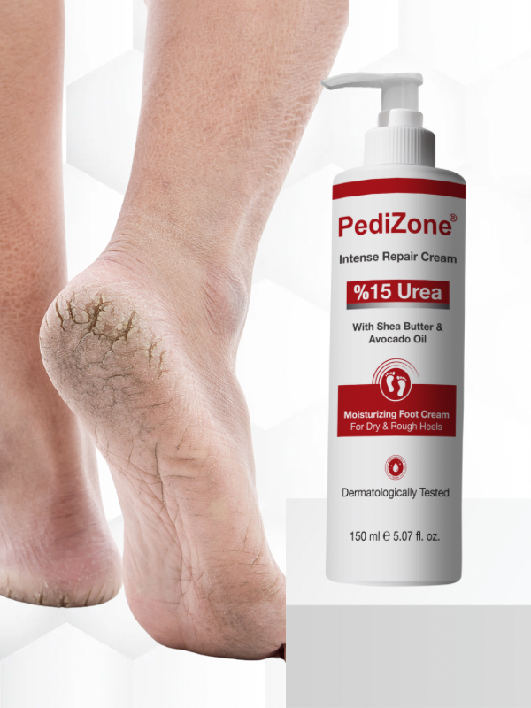 Pedizone %15 Üreli Onarıcı Çatlak Topuk ve Ayak Kremi